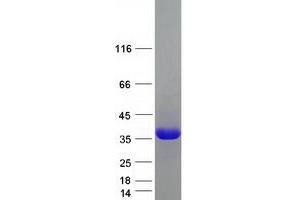 Validation with Western Blot
