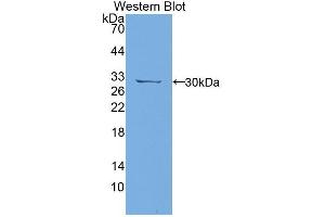 Western blot analysis of the recombinant protein. (PTPRJ 抗体  (AA 1033-1277))