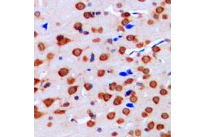 Immunohistochemical analysis of ERK1/2 staining in human brain formalin fixed paraffin embedded tissue section. (ERK1/2 抗体  (Center))