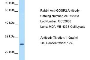 Western Blotting (WB) image for anti-Golgi SNAP Receptor Complex Member 2 (GOSR2) (N-Term) antibody (ABIN2788997) (GOSR2 抗体  (N-Term))