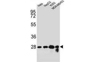 Western blot analysis in Hela, HepG2, K562, MDA-MB453 cell line lysates (35ug/lane) using Cholinephosphotransferase 1 Antibody (N-term). (CHPT1 抗体  (N-Term))