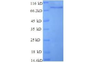 SDS-PAGE (SDS) image for Enolase 1 (ENO1) (AA 2-428), (partial) protein (GST tag) (ABIN5712223) (ENO1 Protein (AA 2-428, partial) (GST tag))