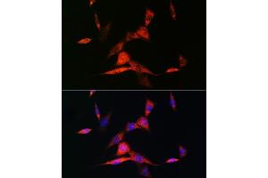 Immunofluorescence analysis of NIH-3T3 cells using RARβ Rabbit mAb (ABIN7269947) at dilution of 1:100 (40x lens). (Retinoic Acid Receptor beta 抗体)