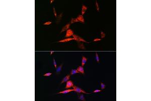 Immunofluorescence analysis of NIH-3T3 cells using RARβ Rabbit mAb (ABIN7269947) at dilution of 1:100 (40x lens).