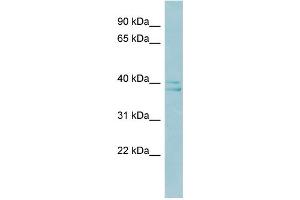 WB Suggested Anti-RAD51AP1 Antibody Titration:  0. (RAD51AP1 抗体  (Middle Region))