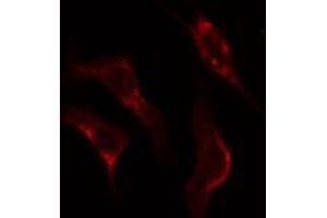 ABIN6274927 staining Hela cells by IF/ICC. (BCAS4 抗体)