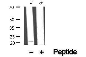 Western blot analysis of extracts of C6 cells, using RAP1B antibody. (RAP1B 抗体  (C-Term))