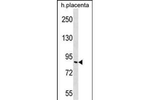 G Antibody (Center) (ABIN656514 and ABIN2845785) western blot analysis in human placenta tissue lysates (35 μg/lane). (GP111 抗体  (AA 366-393))