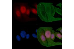 ABIN6255382 and ABIN6267604 staining Hela cells(30 min of UV treatment) by IF/ICC.