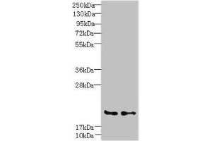 Western blot All lanes: C20orf27 antibody at 6 μg/mL Lane 1: HCT116 whole cell lysate Lane 2: MDA-MB-231 whole cell lysate Secondary Goat polyclonal to rabbit IgG at 1/10000 dilution Predicted band size: 20, 22 kDa Observed band size: 20 kDa (C2orf27A 抗体  (AA 3-174))