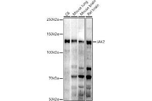Western blot analysis of extracts of various cell lines, using J antibody (ABIN7268040) at 1:1000 dilution. (JAK2 抗体)