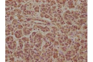 IHC image of ABIN7170322 diluted at 1:100 and staining in paraffin-embedded human pancreatic tissue performed on a Leica BondTM system. (SOS2 抗体  (AA 187-404))