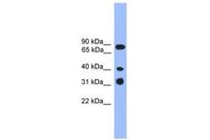 Image no. 1 for anti-Lymphocyte Transmembrane Adaptor 1 (LAX1) (C-Term) antibody (ABIN6745351) (LAX1 抗体  (C-Term))