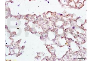 Formalin-fixed and paraffin embedded rat lung tissue labeled with Anti-PAX2 Polyclonal Antibody, Unconjugated (ABIN738951) at 1:200 followed by conjugation to the secondary antibody and DAB staining (PAX2A 抗体)
