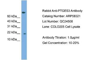WB Suggested Anti-PTGES3  Antibody Titration: 0.