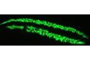 Image no. 1 for anti-Actin, Alpha, Cardiac Muscle 1 (ACTC1) antibody (ABIN959519) (ACTC1 抗体)