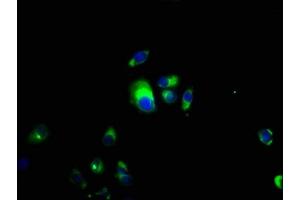 Immunofluorescence (IF) image for anti-Colony Stimulating Factor 2 Receptor, Beta (CSF2RB) (AA 492-710) antibody (ABIN7149290)