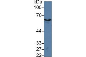 Western Blot; Sample: Mouse Skin lysate; Primary Ab: 3µg/ml Rabbit Anti-Mouse KRT2 Antibody Second Ab: 0. (Keratin 2 抗体  (AA 200-508))