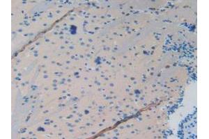 IHC-P analysis of Mouse Brain Tissue, with DAB staining. (MAPT 抗体  (AA 92-400))