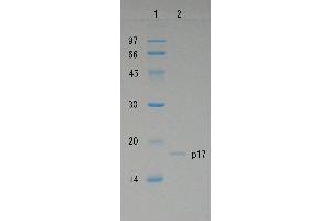 SDS-PAGE (SDS) image for Human Immunodeficiency Virus 1 Matrix (HIV-1 p17) protein (ABIN2452193)