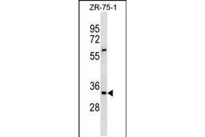 Western blot analysis in ZR-75-1 cell line lysates (35ug/lane). (ING2 抗体  (AA 112-141))