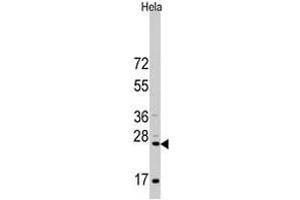 Western blot analysis of CD8A polyclonal antibody  in HeLa cell line lysates (35 ug/lane). (CD8 alpha 抗体  (N-Term))