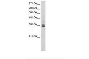 Image no. 1 for anti-Zinc Finger Protein 197 (ZNF197) (N-Term) antibody (ABIN6736240) (ZNF197 抗体  (N-Term))