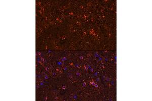 Immunofluorescence (IF) image for anti-Glutamate Decarboxylase 2 (Pancreatic Islets and Brain, 65kDa) (GAD2) (AA 401-585) antibody (ABIN3021188)