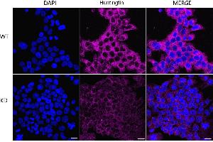Immunocytochemical staining of HeLa cells using Huntingtin antibody (ABIN7799005), 1:1,000), Top panel: wild-type (WT), Bottom panal: Huntingtin shRNA knockdown (KD). (Recombinant Huntingtin 抗体)
