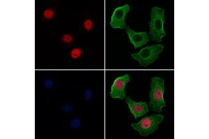 ABIN6256094 and ABIN6267526 staining Hela cells(4h of LPS treatment) by IF/ICC.
