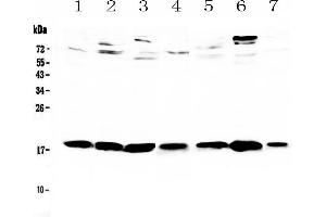 Western blot analysis of HE4 using anti-HE4 antibody . (WFDC2 抗体  (AA 31-168))