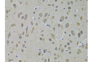 Immunohistochemistry of paraffin-embedded rat brain using ADH5 antibody (ABIN6292597) at dilution of 1:100 (40x lens). (ADH5 抗体)