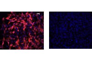 Immunofluorescence Microscopy of Mouse Anti-IDO1 Antibody. (IDO1 抗体)