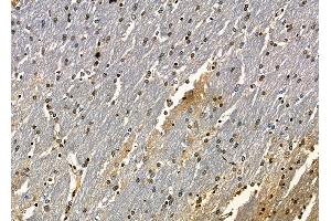 ABIN6262437 and ABIN6278874 at 1/100 staining rat brain tissue by IHC-P. (CARD18 抗体  (C-Term))