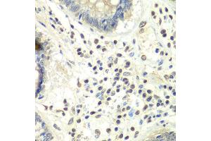 Immunohistochemistry of paraffin-embedded human colon using PRMT5 antibody at dilution of 1:100 (x40 lens). (PRMT5 抗体)