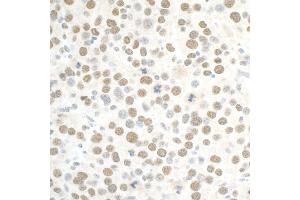 Immunohistochemistry (IHC) image for anti-Polybromo 1 (PBRM1) (AA 1639-1689) antibody (ABIN7453903)