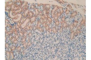 DAB staining on IHC-P; Samples: Mouse Kidney Tissue (PLXNB1 抗体  (AA 1598-1849))