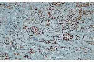 Immunohistochemistry (IHC) image for anti-Napsin A Aspartic Peptidase (NAPSA) (N-Term) antibody (ABIN7598894) (NAPSA 抗体  (N-Term))