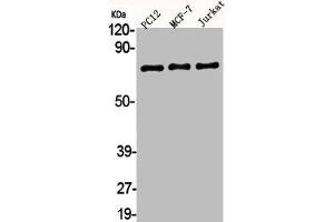 Western Blot analysis of PC12 MCF7 Jurkat cells using AKAP 95 Polyclonal Antibody (AKAP8 抗体  (Internal Region))