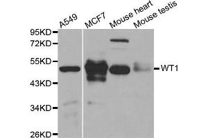Western blot analysis of extracts of various cell lines, using WT1 antibody. (WT1 抗体)