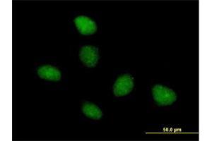 Immunofluorescence of purified MaxPab antibody to TAF15 on HeLa cell. (TAF15 抗体  (AA 1-592))