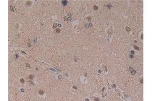 Detection of MFAP2 in Human Brain Tissue using Polyclonal Antibody to Microfibrillar Associated Protein 2 (MFAP2) (MFAP2 抗体  (AA 6-162))
