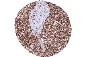 anti-Succinate Dehydrogenase Complex, Subunit B, Iron Sulfur (Ip) (SDHB) antibody