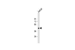 Anti-ST3GAL5 Antibody (C-term) at 1:1000 dilution + Jurkat whole cell lysate Lysates/proteins at 20 μg per lane. (ST3GAL5 抗体  (AA 389-418))