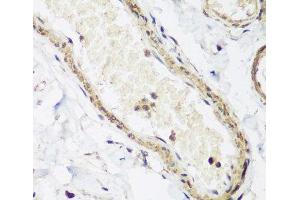 Immunohistochemistry of paraffin-embedded Human colon using CAV3 Polyclonal Antibody at dilution of 1:200 (40x lens). (Caveolin 3 抗体)