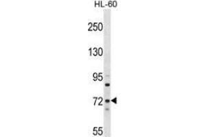 Western blot analysis in HL-60 cell line lysates (35ug/lane) using MTMR6 Antibody (N-term). (MTMR6 抗体  (N-Term))