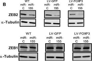 miR-155 and FOXP3 down regulate endogenous ZEB2 in human breast cancer cells resulting in altered levels of EMT markers Vimentin and E-cadherin(A) Relative abundance of ZEB2 and ZEB1 protein in WT, GFP or FOXP3 overexpressing BT549 cells transfected with miR-155 or miR-control. (alpha Tubulin 抗体  (Internal Region))