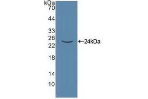 Western blot analysis of recombinant Human PANX1. (PANX1 抗体  (AA 228-411))