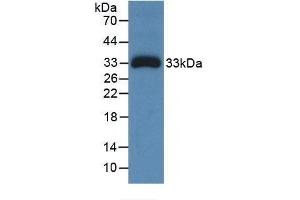 Detection of Recombinant Ceruloplasmin, Human using Monoclonal Antibody to Ceruloplasmin (CP) (Ceruloplasmin 抗体  (AA 789-1065))