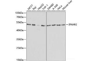 Western blot analysis of extracts of various cell lines using IFNAR2 Polyclonal Antibody at dilution of 1:1000. (IFNAR2 抗体)